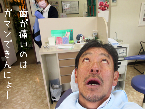 歯痛